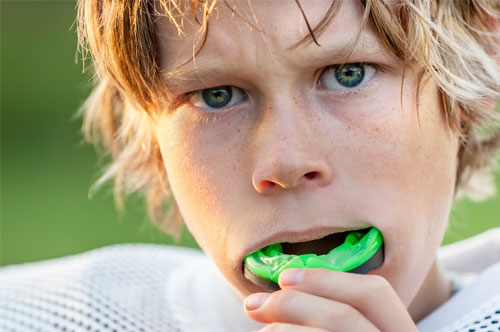 5 Reasons Why You Should Get a Custom Sports Mouthguard