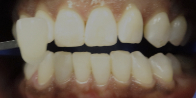 zoom new-updated-3